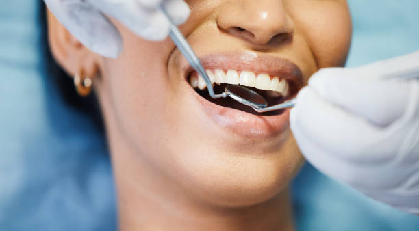 Best Cosmetic Emergency Dentistry in Ruston, WA